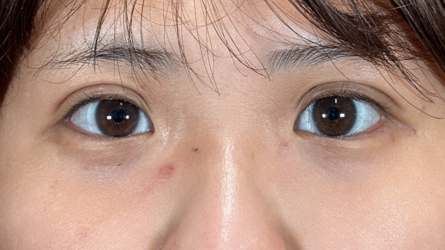 手术前的状态 其一