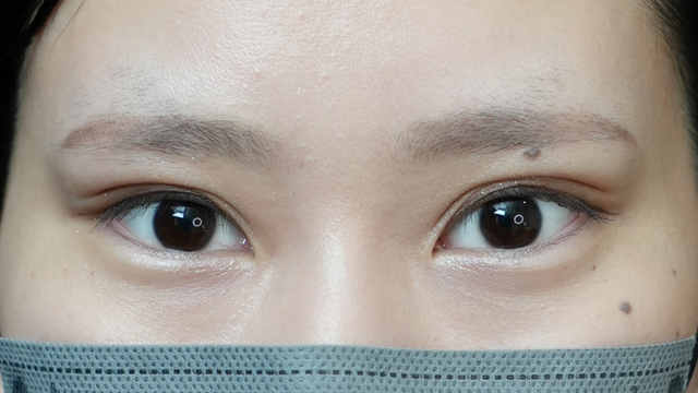 Postoperative Condition Part 1