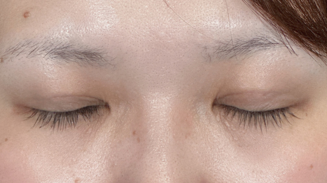 Postoperative Condition Part 1