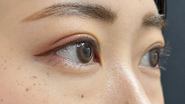 手术前的状态 其一