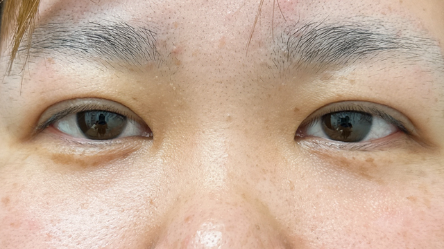 Postoperative Condition Part 1