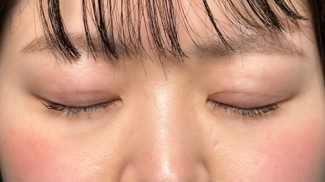 手术前的状态 其一