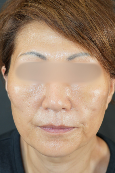 手术前的状态 其一