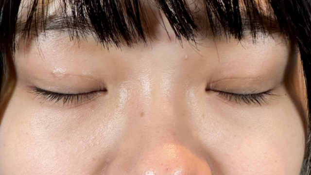 手术前的状态 其一