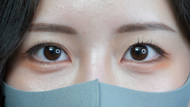 手术前的状态 其一