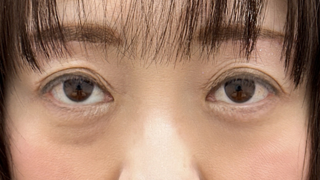 Postoperative Condition Part 1