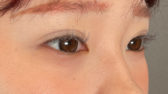 手术前的状态 其一