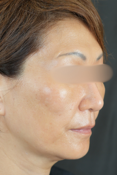 手術前の状態 その1