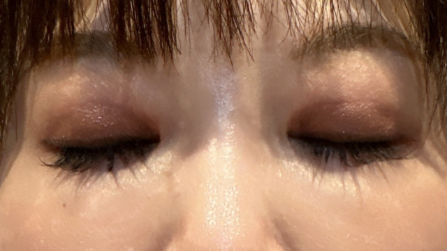 手术前的状态 其一