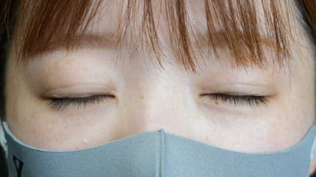 手术前的状态 其一