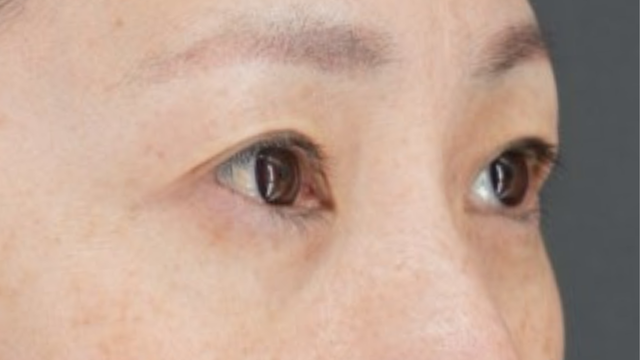 手术前的状态 其一