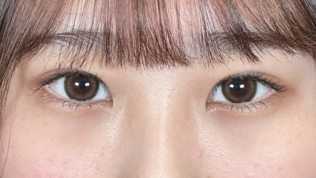 手术前的状态 其一