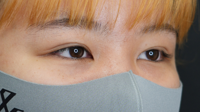 手术前的状态 其一