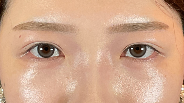 Postoperative Condition Part 1