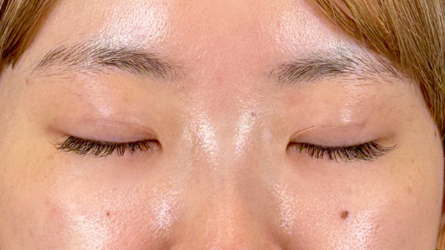 Postoperative Condition Part 1