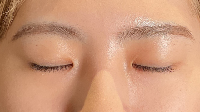 手術前の状態 その1