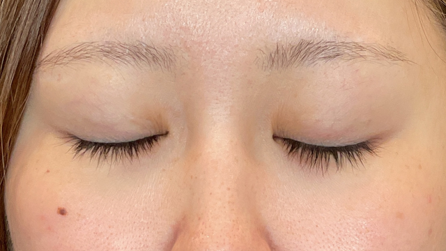 Postoperative Condition Part 1