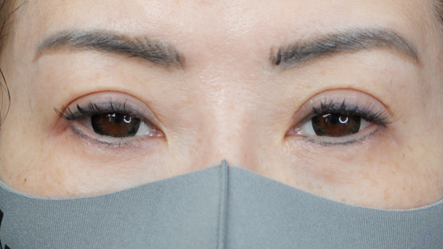 Postoperative Condition Part 1