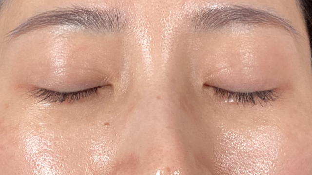 手术前的状态 其一