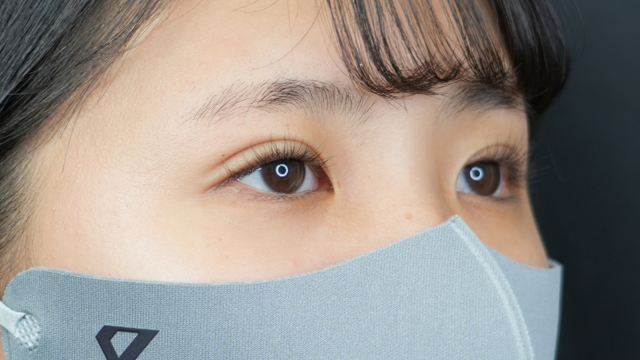 手术前的状态 其一