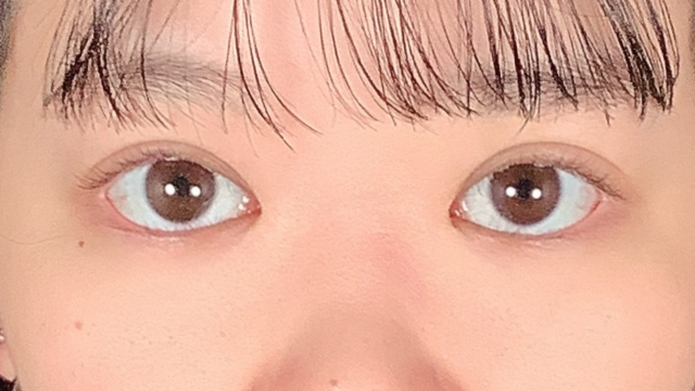 手术前的状态 其一