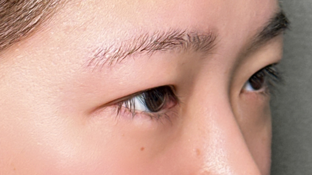 手术前的状态 其一