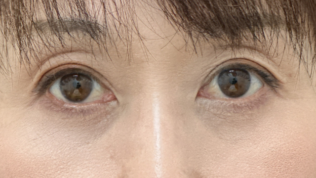 手术前的状态 其一