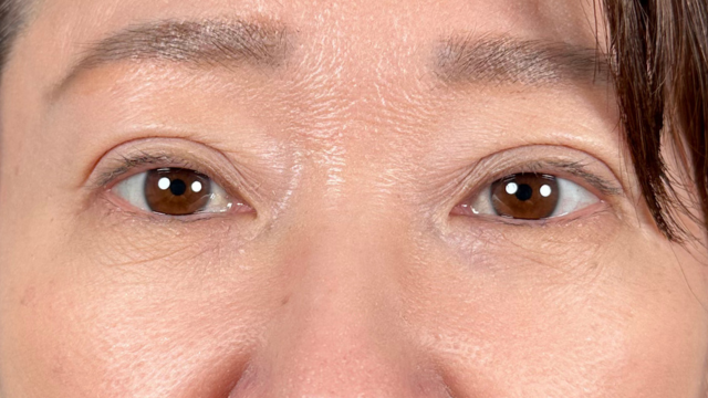 手術前の状態 その1