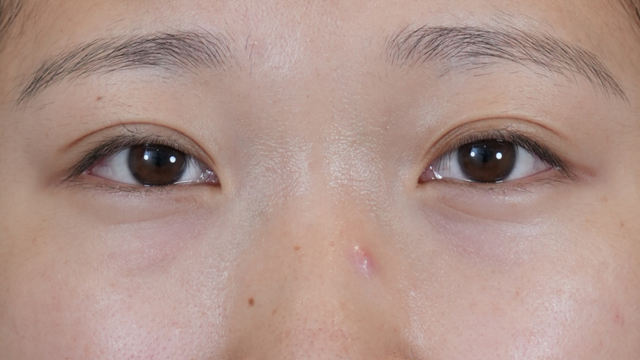 手術前の状態 その1