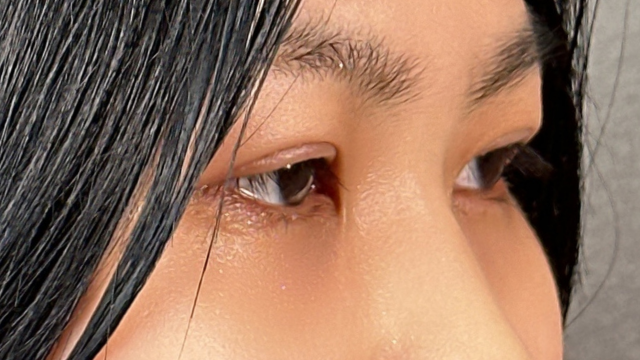 手术前的状态 其一