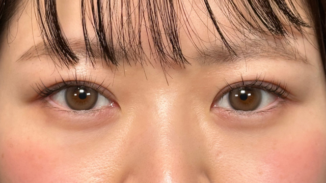 手术前的状态 其一