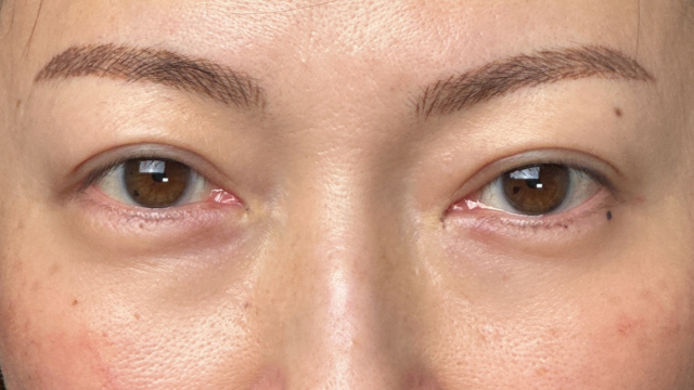 手术前的状态 其一