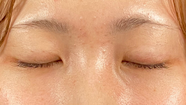 手术前的状态 其一