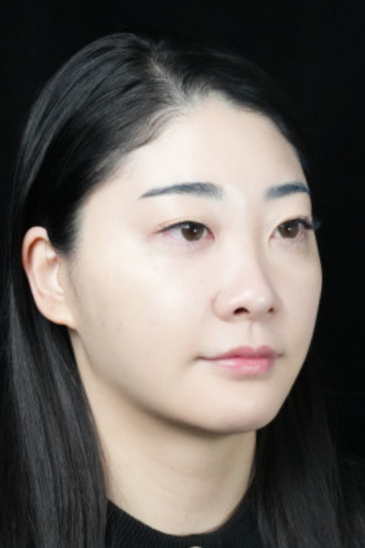 手术前的状态 其一