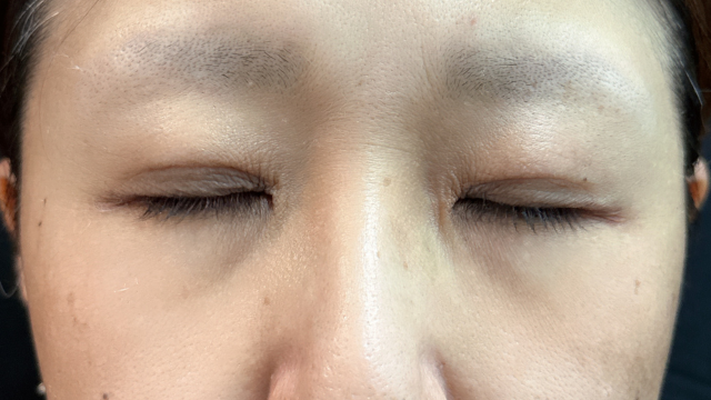 Postoperative Condition Part 1