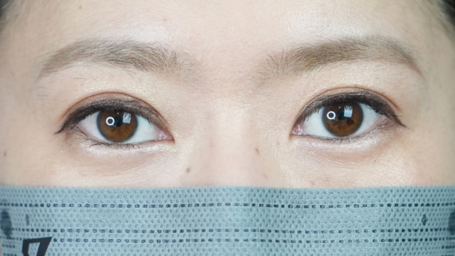 手术前的状态 其一