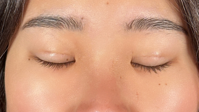 手术前的状态 其一