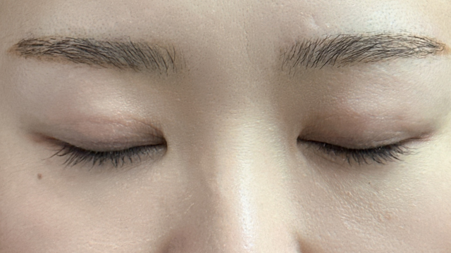 手术前的状态 其一