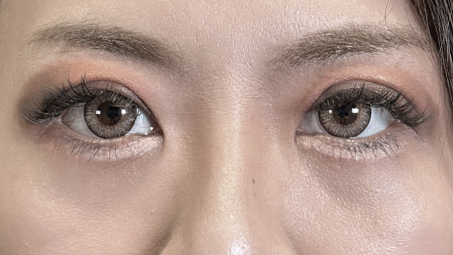 Postoperative Condition Part 1