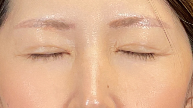 Postoperative Condition Part 1