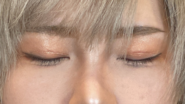 手術前の状態 その1