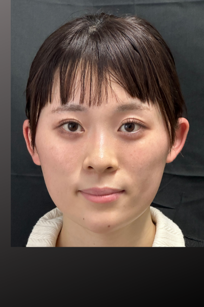 手術前の状態 その1