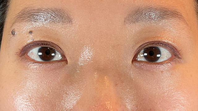 Postoperative Condition Part 1