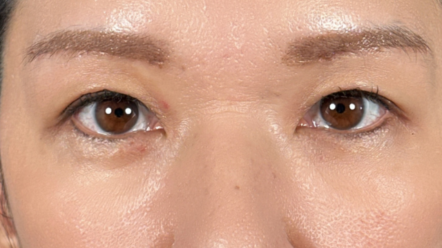 Postoperative Condition Part 1