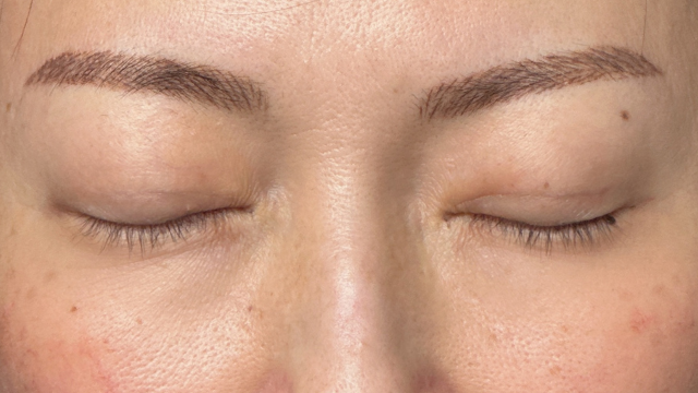 手术前的状态 其一