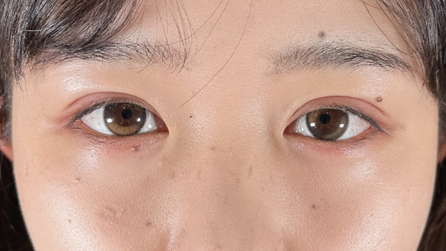 手术前的状态 其一