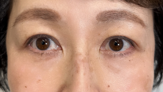 手术前的状态 其一