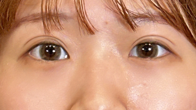 手术前的状态 其一