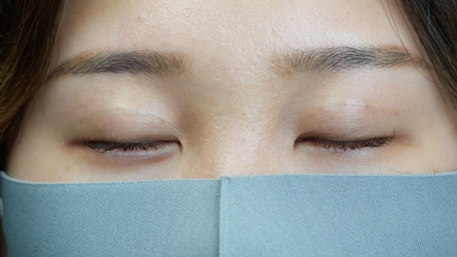 手術前の状態 その1