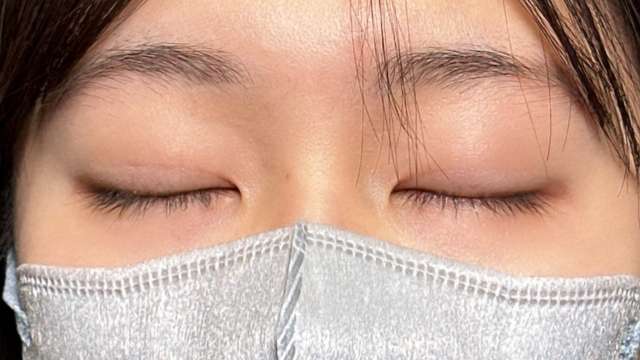 手术前的状态 其一